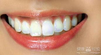 成人牙齿如何养护好视频,全方位视频教程解析  第1张